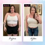 Wegovy Before and After: Transformations, Benefits, and Insights